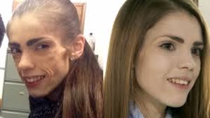 Jersey charity seeing more youngsters with eating disorders