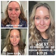 Hair recovery products for volume and shine