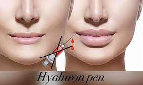 So that it makes the skin smooth, soft, bright and. Hyaluron Pen Isabelle Franco