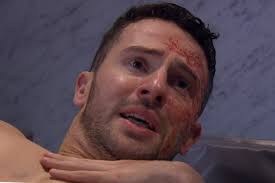 Emmerdale viewers 'appalled' by 'disturbing' Ross Barton acid attack scenes 