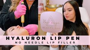 The active ingredient used, hyaluronic acid, rejuvenates and lifts the lip area, as well. Lip Filler Without Needles Hyaluron Lip Pen Treatment Youtube