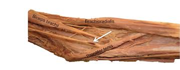Causes of median nerve damage. Cureus Median Nerve Palsies Due To Injections A Review