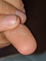 Image result for Pinworm