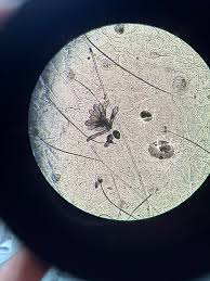 Image result for Demodex folliculorum