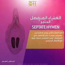 استكمالا موضوع البعبع غشاء البكارة هنتكلم النهاردة عن أنواع غشاء البكارة ولتسهيل ال المعلومة كتبنا أهم المعلومات على كل صورة لتصبح معلومة thumbs up hospital