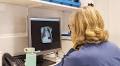 AI-Driven Initiative at Sutter Health Doubles Early Lung Cancer Detection Rates