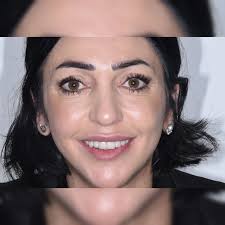 yassin iyad (@dr.yassiniyad) • Instagram photos and videos