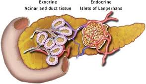 Mar 24, 2021 · longstanding chronic pancreatitis can lead to type 1 diabetes or pancreatic insufficiency. Introduction To Pancreatic Disease Chronic Pancreatitis Pancreapedia