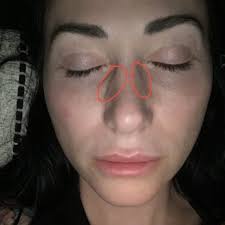 KARE PLASTIC SURGERY & SKIN HEALTH CLINIC