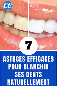 Les 7 Astuces Efficaces Pour Blanchir Ses Dents Naturellement Blanchir Les Dents Naturellement Blanchir Les Dents Blanchiment Dentaire Naturel