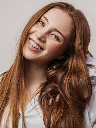 Orthodontic FAQs-Greenville NC