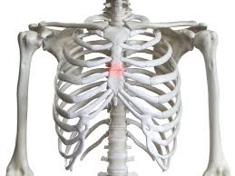 Image result for Sternal Fracture