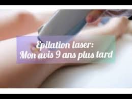 Mon Epilation Laser Avis 9 Ans Plus Tard Youtube