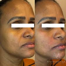 Ana Livia Marzoque (@dra.anamarzoque) • Instagram फोटोहरू र भिडियोहरू