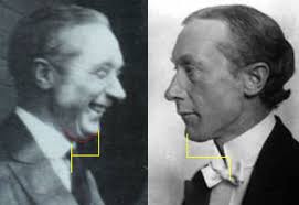 Everything you wanted to know about Alexander's depressed larynx but were  afraid to ask