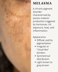 Image result for Diffuse Hyperpigmentation