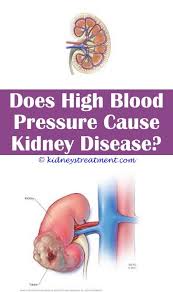 Pin On Kidney Disease