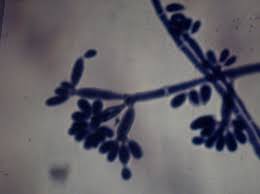 Fonsecaea is a genus of fungi in the family herpotrichiellaceae. File Fonsecaea Jpg Wikimedia Commons