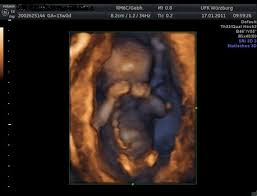 Dagmar nagel | letzte aktualisierung: Dein Baby In 3d Was Bietet Ein 3d Ultraschall Und Wann Ist Er Erlaubt Netmoms De