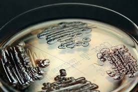 Wir schwächen und killen bakterien. Wie Kommen Multiresistente Bakterien Ins Krankenhaus Healthcare In Europe Com