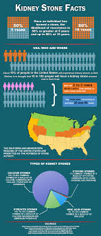 6 Infographics To Help You Avoid A Kidney Stone Attack Like The One That Struck Amazon Ceo Jeff Bezos Kidney Stones Kidney Stone Relief Kidney