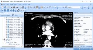 Microdicom dicom viewer can export dicom images to common graphics formats and videos. 16 Best Free Dicom Viewer Software For Windows