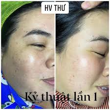 Spa Ngọc Diệp Thạnh Phú Bến Tre