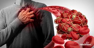 Image result for Coagulation Bleeding Disorder