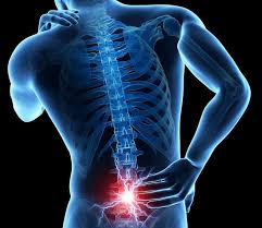 La hernia de disco se presenta cuando el anillo fibroso se rompe y se abre o agrieta, permitiendo que escape el núcleo pulposo. Exista Tratament Hernie De Disc Fara Operatie Convinge Te Aici