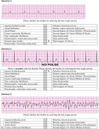 3rd degree block (complete heart block) 2. Manual Book Pdf Free Download Agustus 2010