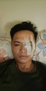 Fundraiser by Jerson Jardiel : Kyle's Fight Against Blindness