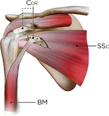 The conjoint tendon formed by the short head of biceps brachii and coracobrachial muscles is attached to the tip of the cp. Postoperative Shoulder Imaging Rotator Cuff Labrum And Biceps Tendon Radiographics