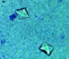 Calcium oxalate is presently the most common crystal and stone found in cats. Calcium Oxalate Stones Feline Mar Vista Animal Medical Center
