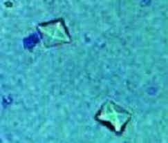 Thebarkspace.com is a participant in the amazon services llc associates program, an affiliate advertising program designed to provide a means for sites to earn advertising fees by advertising and linking to amazon.com. Calcium Oxalate Stones Feline Mar Vista Animal Medical Center