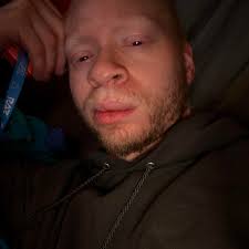 A new study shows that psilocybin obliterates your neural fingerprint.  “Their individuality is temporarily wiped out." A new brain-imaging study  has revealed that psilocybin — the active compound in magic mushrooms —