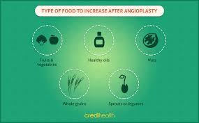 Indian Diet After Angioplasty What To Eat And What To Avoid