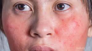 Maybe you would like to learn more about one of these? Jangan Coba Coba Pemutih Racikan Abal Abal Ini Berbahaya