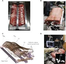 This sign can be seen in patients with paget disease. Frontiers Evaluation Of An Ultrasound Based Navigation System For Spine Neurosurgery A Porcine Cadaver Study Oncology