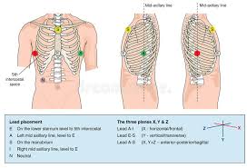 lead placement stock illustrations 12 lead placement stock