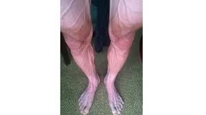 Tour de france cyclist's insanely veiny legs shock and awe. Cyclist Shares Photo Of What A Tour De France Stage Does To Your Legs Pic Total Pro Sports