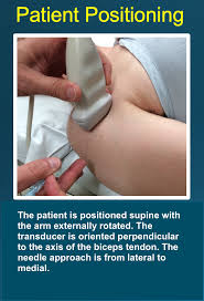 Image result for Biceps Tendon Injection