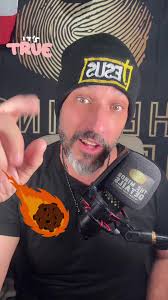 Detroit News Reporter Skin Turning White Blotchy