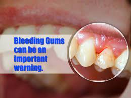 Pin On Dental Info