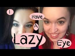 How to fix a lazy eye tutorials (serif and customer created tutorials) affinity. Lazy Eye I My Story Misconceptions Treatment Youtube