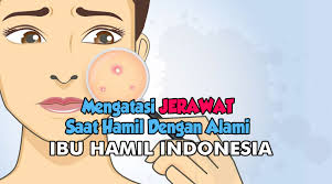 Cairan callusol digunakan dengan cara dioleskan langsung ke daerah yang mengalami mata ikan, kutil, dan kapalan. Mengatasi Jerawat Saat Hamil Dengan Alami