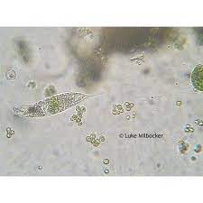 If you would like to know more about canine coccidia, visit our great coccidiosis page. Microscopy Protozoans Microbus Microscope Educational Website