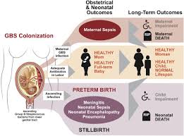 Image result for Group B Streptococcus