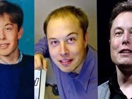 Elon musk is one of the first investors in deepmind, he helped set up the $1 billion openai research tech billionaire elon musk likes to think he knows a thing or two about artificial intelligence (ai), but. Real Truth About Elon Musk S Plastic Surgery Facelift Hair Transplant