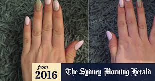 Little fingers range from perfectly straight to bending inwards at a sharp angle. Is Smartphone Pinky Real Probably Not But Phones Can Still Cause Damage