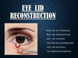 An expressive glance and the lack of. Upper Eye Lid Recon Flip Ebook Pages 1 22 Anyflip Anyflip